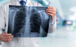 Ekspert: Za 2 miesiące może być we Włoszech 16 tys. zakażeń dziennie