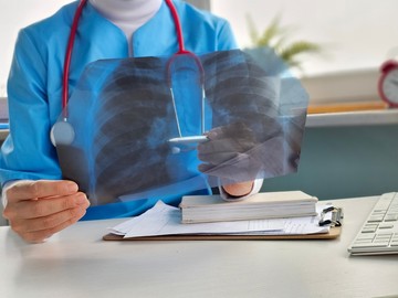 A HMPV egy légúti vírus, amely a megfázáshoz és az influenzához hasonló tüneteket okoz. Bár a betegség jellemzően enyhe, olykor súlyos szövődményekhez, például tüdőgyulladáshoz vezethet, különösen csecsemőknél, időseknél és legyengült immunrendszerűeknél.