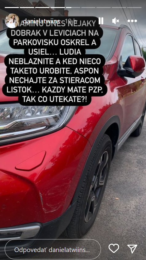 Twiinsky porozprávali o nepríjemnom zážitku. 