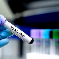 HbA1c, a cukorbetegek időgépe: miért kell ellenőrizni, és miért nehéz néha beállítani?