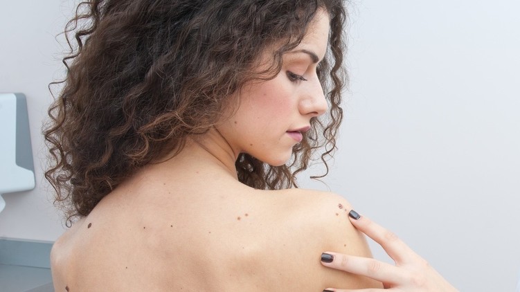 mohs_micrographic_surgery_can_help_treat_skin_cancer