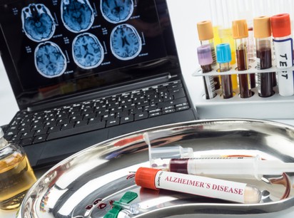 Mérföldkő az Alzheimer-kór diagnózisában – itt az első vérvizsgálati teszt, amit az FDA is jóváhagyott