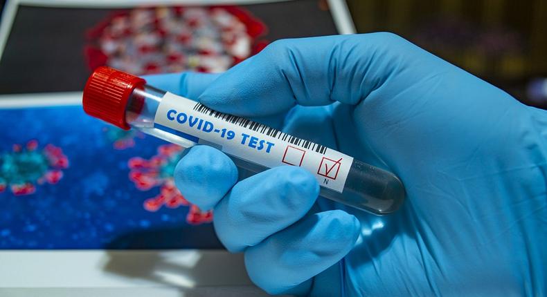 CORONAVIRUS : 68 NOUVEAUX CAS POSITIFS, HAUSSE DES CAS GRAVES