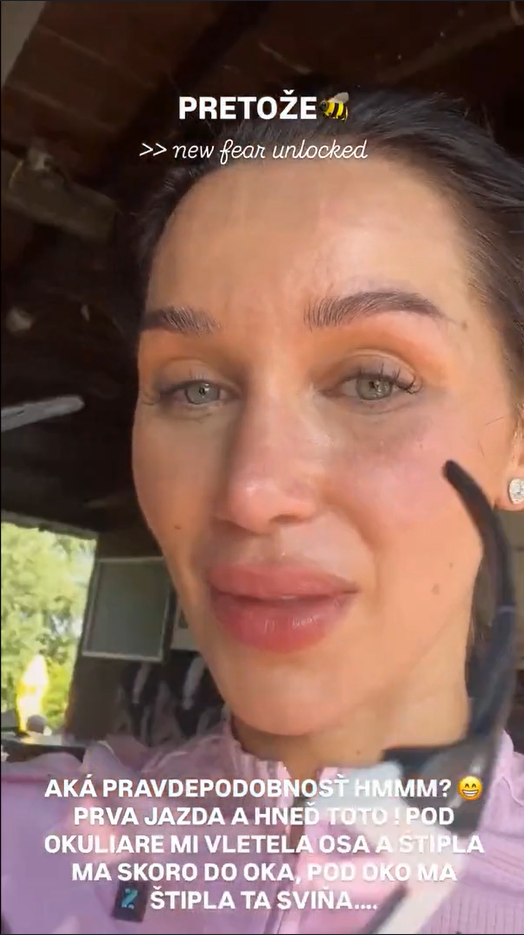 Bianku Rumanovú počas jazdy na bicykli poštípala pod okom osa. 