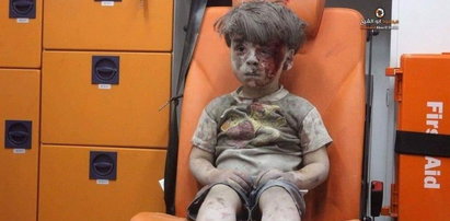 Zmarł brat chłopca z Aleppo. Miał zaledwie 10 lat