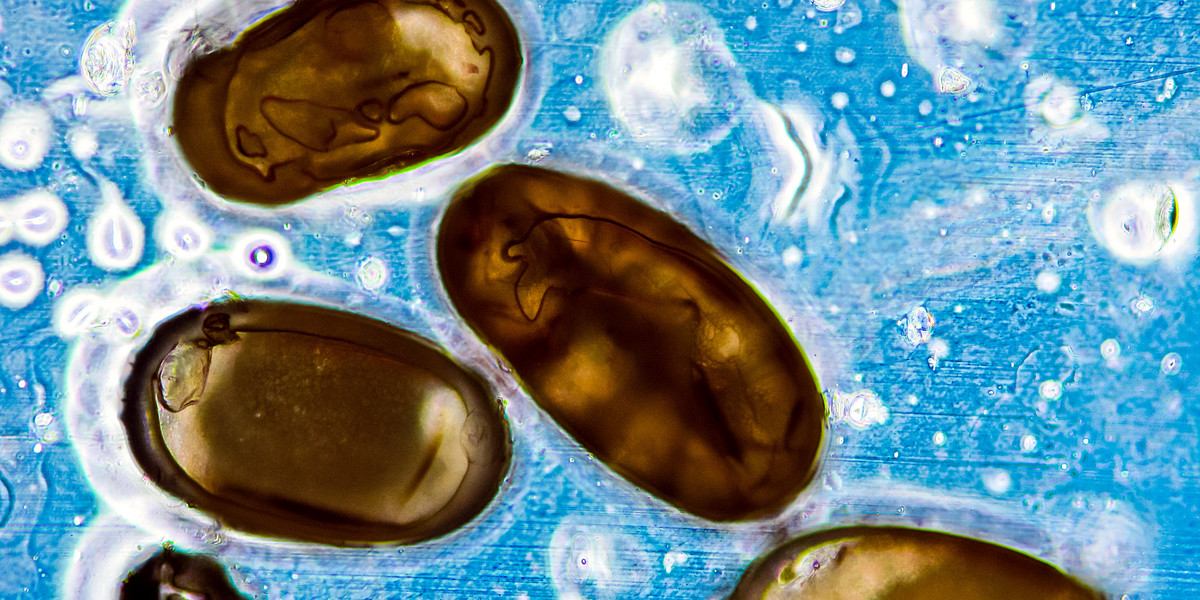 Bakcyle dżumy pod mikroskopem wyglądają niewinnie. 