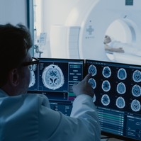 Mikor és miért van szükség agyi CT vizsgálatra? Itt a válasz