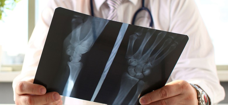 Implant "dekorowany" substancjami dla szybszego gojeni kości. Przełomowe badania