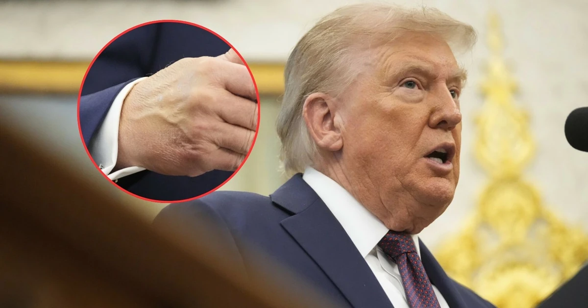 News about Trump's illness was buzzing on the Internet. The US president   broke his silence