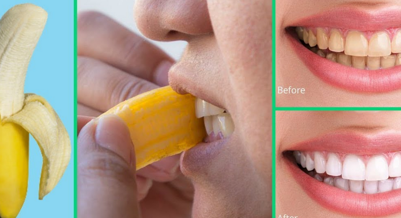 How to whiten the teeth using banana peels