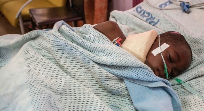 A child is treated in hospital after being injured during a stampede in Malawi's capital Lilongwe on July 6, 2017