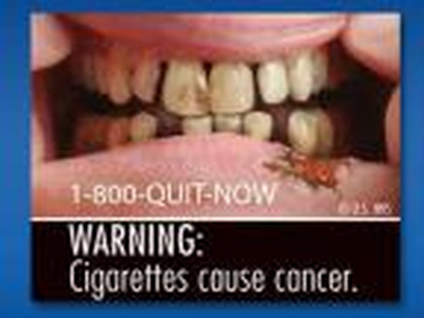 Od września producenci papierosów w USA muszą sprzedawać paczki z koszmarnymi zdjęciami odstraszającymi od palenia. fot.fda.gov