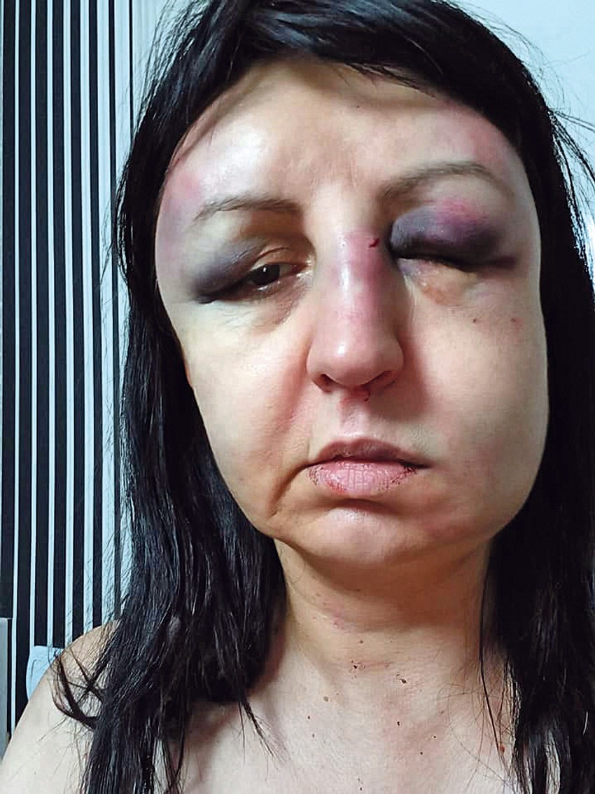 Pretučena pravnica D. R.