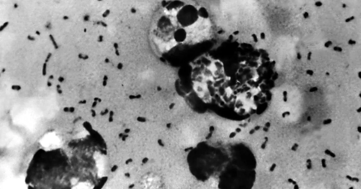 Epidemia dżumy w Rosji? Pierwszy śmiertelny przypadek na Syberii