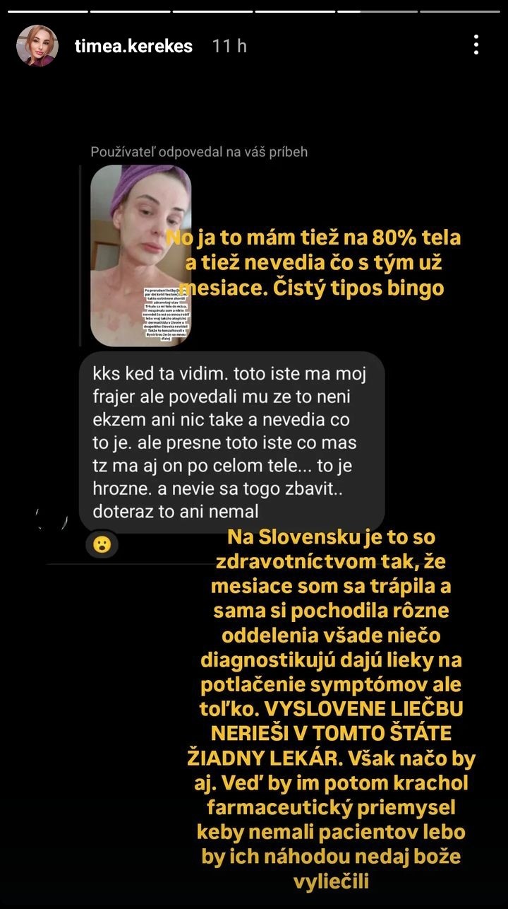 Timea Kerekeš bojuje s nepríjemnými zdravotnými problémami.