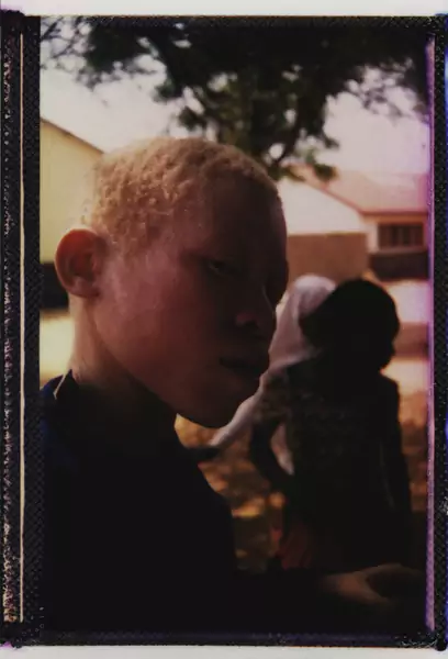 Ośrodki dla dzieci z albinizmem tworzone w Tanzanii miały chronić najmłodszych, ale jeszcze bardziej wyrzuciły ich poza społeczeństwo.