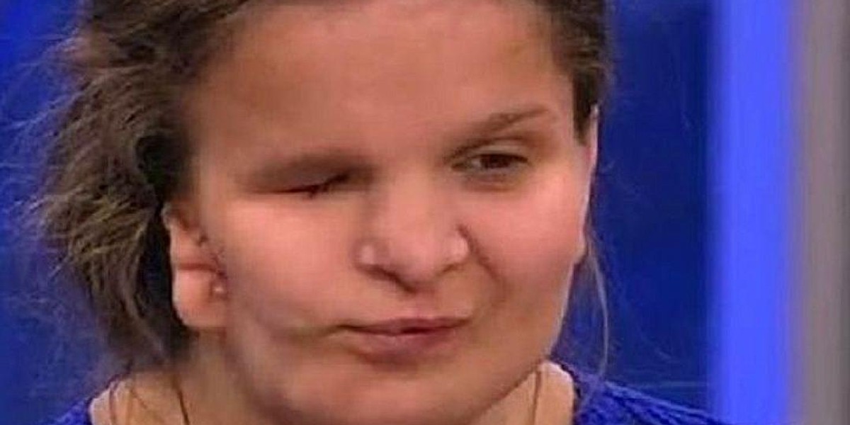 Katia Badajewa umarła w trakcie operacji plastycznej