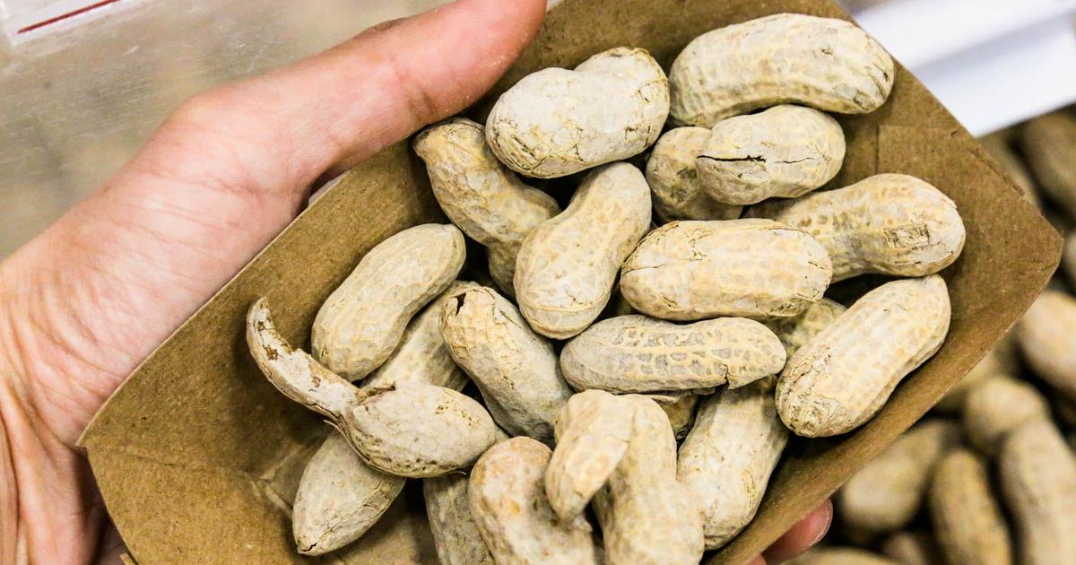 A Woman Whose Vagina Burned After Sex Was Told Her Partners Semen Contained Traces Of Peanuts 