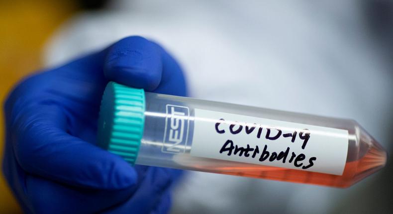 A tube with a solution containing COVID-19 antibodies.