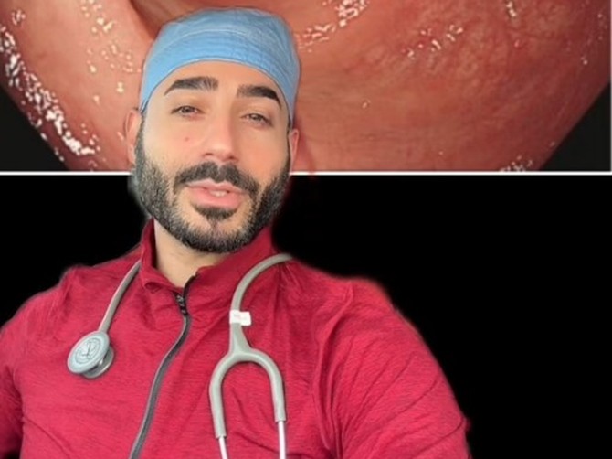 Doktor pokazao kako izgledaju bolesti debelog creva