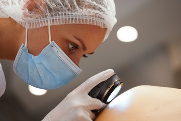 bőrrák, bőrdaganat, melanoma, fényvédelem