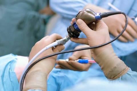 Mitől függ, hogy mennyire fáj a gyomortükrözés?