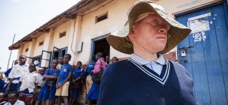 Ludzie duchy. Jak bielactwo determinuje życie w Tanzanii [ZDJĘCIA]