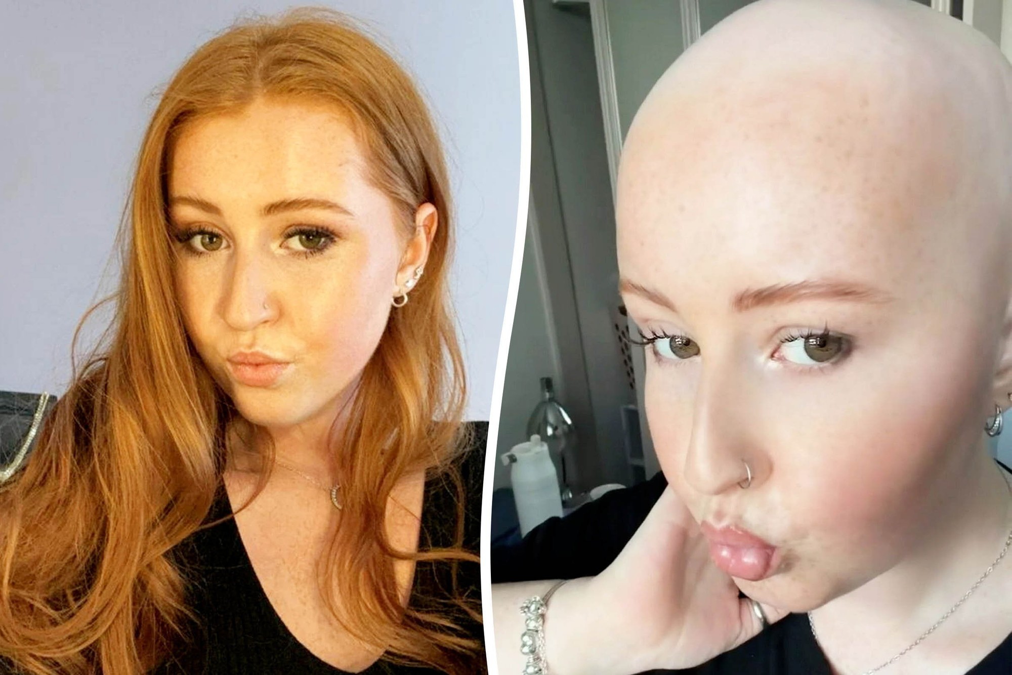 Lekári pripisovali Emmine príznaky možnému natiahnutiu svalu, úzkosti, pneumónii či dokonca artritíde.