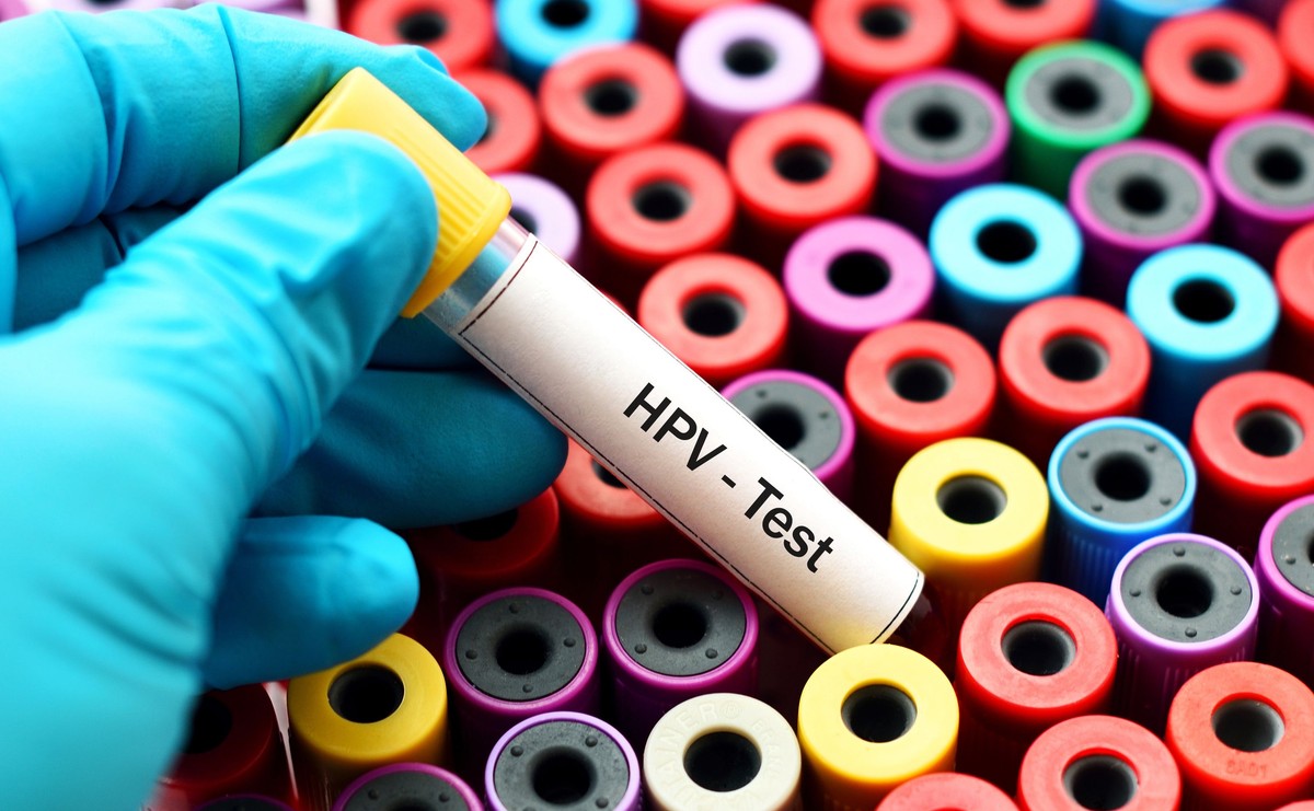 Test HPV