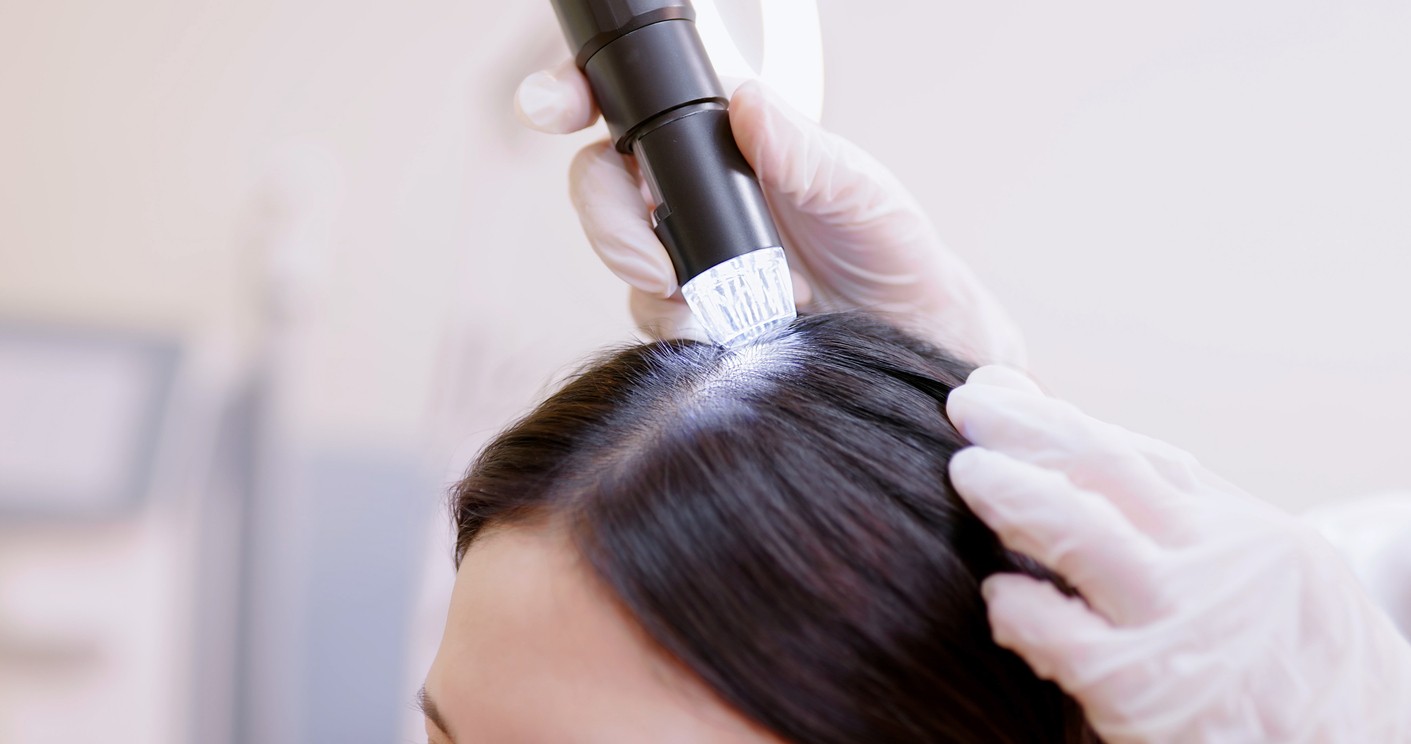 Skin cancer can also hide in the hair. (illustrative photo)