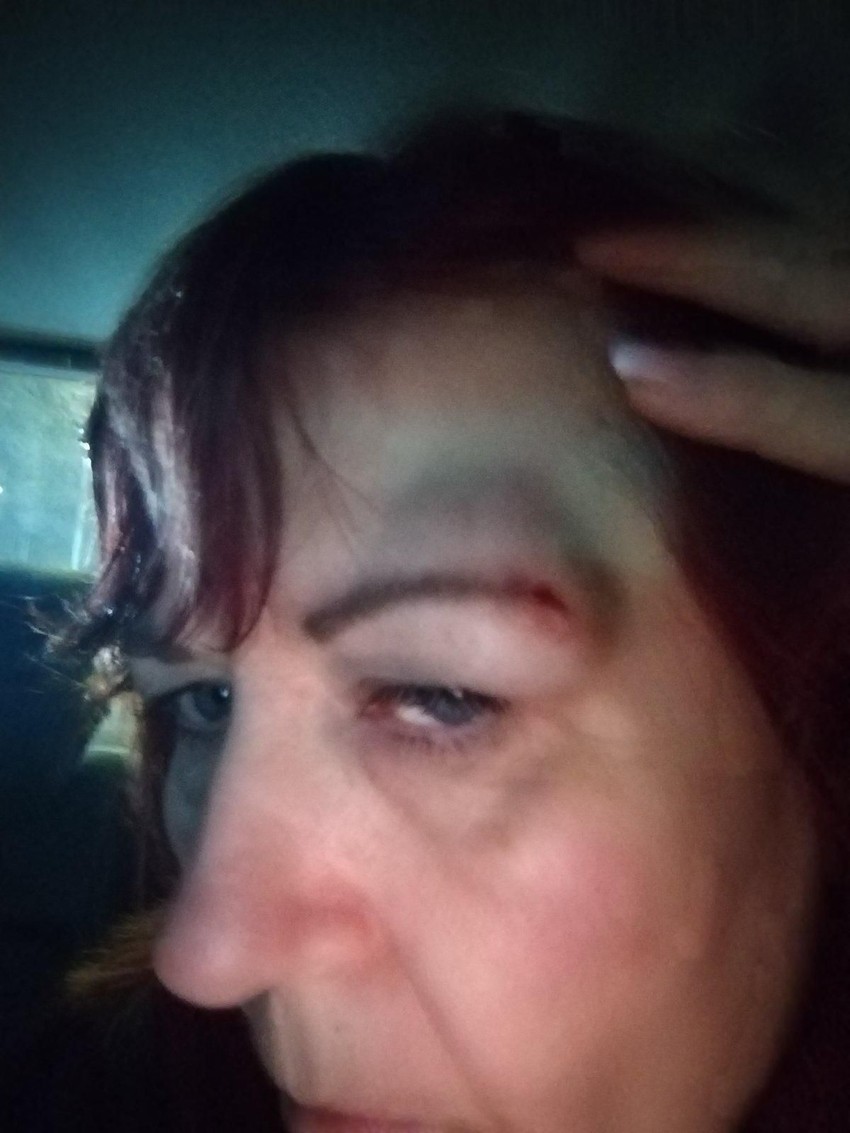 Napadnuta Danijela Krstić