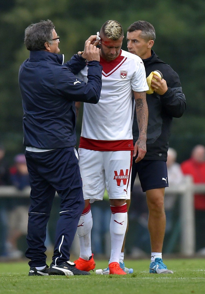 Jeremy Menez doznał koszmarnej kontuzji. Piłkarz Bordeaux stracił kawałek ucha