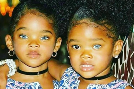 Bile su NAJLEPŠE BLIZNAKINJE PLANETE, a sada su odrasle i evo KAKO IZGLEDAJU: Zaradile 5 MILIONA dolara, a tek su tinejdžerke i svi su OPČINJENI njihovim očima