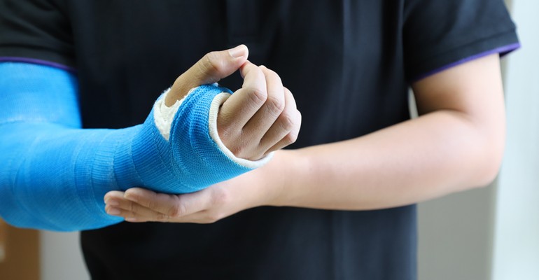 Gips - rodzaje, wady i zalety. Co zamiast gipsu?