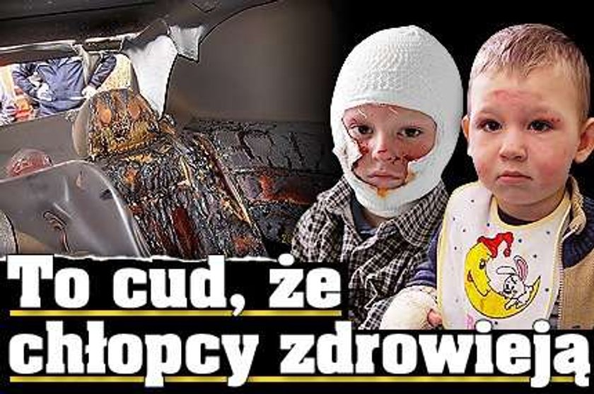 To cud, że poparzeni w pożarze auta chłopcy zdrowieją!