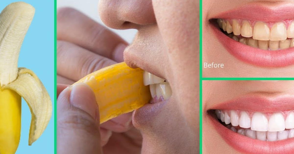 How to whiten the teeth using banana peels Pulse Ghana