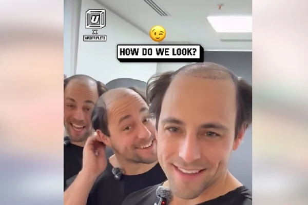 BRAĆA otišla na TRANSPLANTACIJU KOSE U TURSKU i evo kako izgledaju POSLE OPERACIJE U ISTANBULU: "Kada sam video "groblje" na svojoj glavi, morali smo da reagujemo"