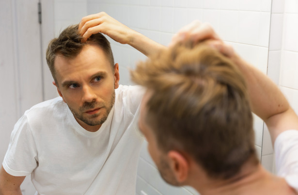 Mężczyźni nie tylko częściej, ale i inaczej tracą włosy niż kobiety wraz z upływem lat