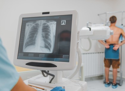 Tüdőrákszűrő napot szervez szombatra az Országos Korányi Pulmonológiai Intézet című cikk nyitóképe