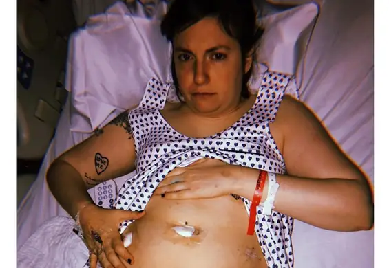 Po usunięciu macicy musiała usunąć także jajnik. Lena Dunham nadal toczy walkę z endometriozą