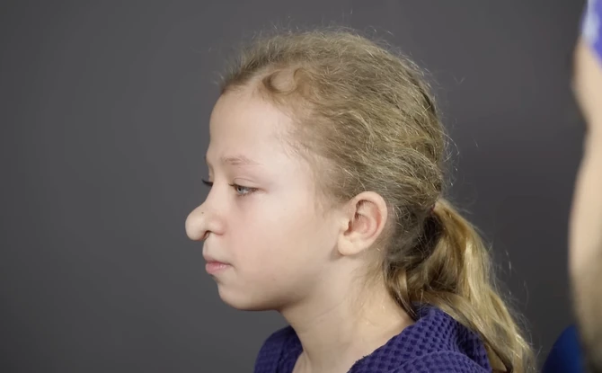 Devojčicu (10) sa deformitetom nosa žele da pošalju u dom