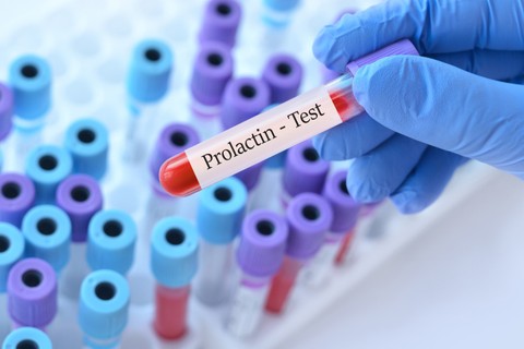 Prolaktin-hiány: tünetei, vizsgálata és kezelési lehetőségei