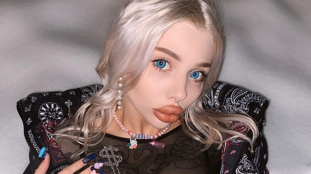 Rosyjska influencerka chciała zmniejszyć usta. Przez ten zabieg otarła się o śmierć