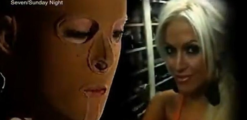 Dana Vulin: Australijanka srpskog porekla bez lica je ostala pre dve i po godine