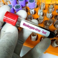 Ez Kemenesi határozott véleménye a felbukkant majomhimlőről
