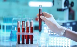 Przeciwciała od ozdrowieńców skuteczne w leczeniu chorych na COVID-19