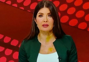 Gordana Stijačić sa mrljama na vratu