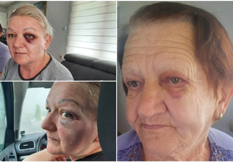 Pretučena Mira Marković iz Stanara