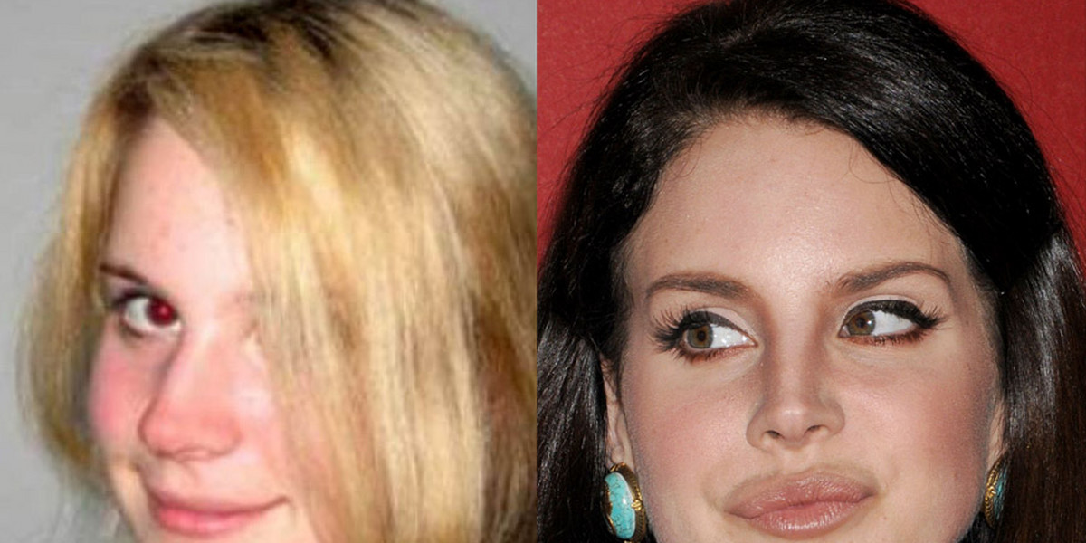 Tak wyglądała Lana Del Rey przed operacjami plastycznymi!