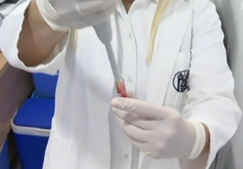 U krv se dodaju i dve kapi razređivača, a kroz 15 minuta test može da se očita